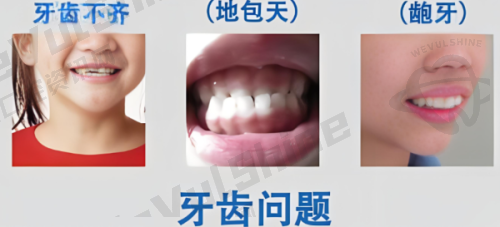 蓝天口腔医院镶牙政策