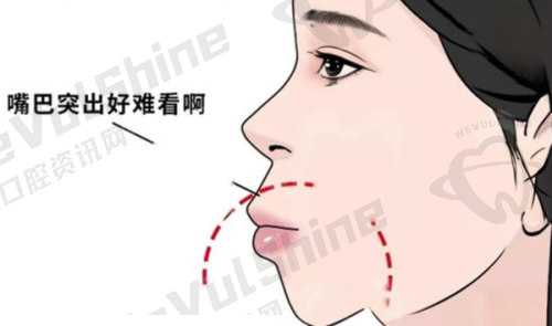 种植牙价格