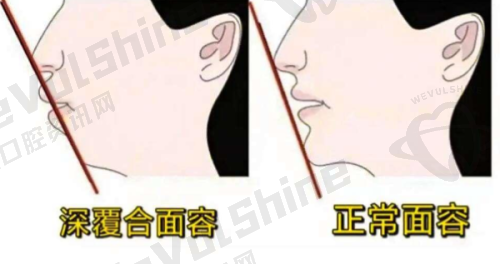 宿迁即刻种植牙情况