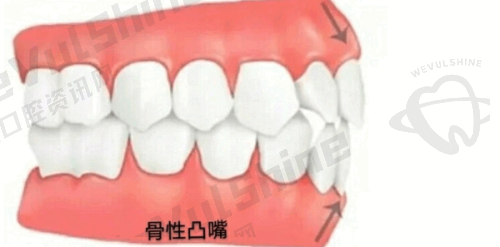 总结