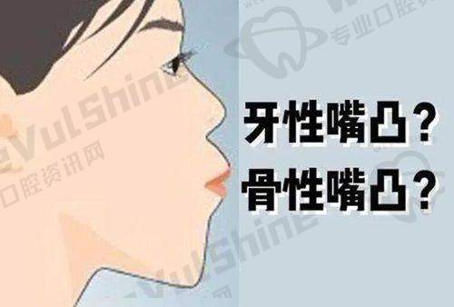 牙冠价格