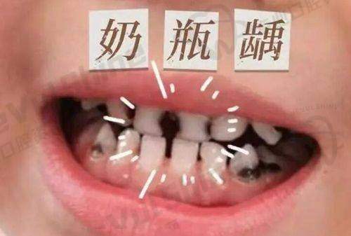 眼部和面部项目参考