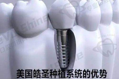 贴心的服务与细节处理