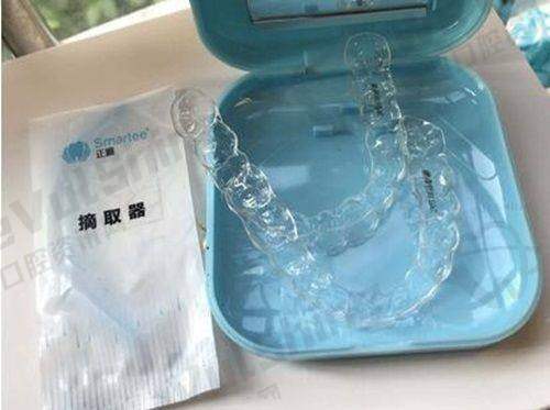 成都圣贝口腔：牙齿矫正与美容修复的专长