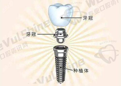 患者的选择与建议
